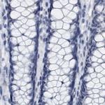 XIRP1 Antibody in Immunohistochemistry (IHC)