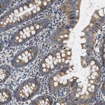 SAMD4B Antibody in Immunohistochemistry (Paraffin) (IHC (P))