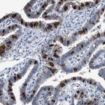 FADS6 Polyclonal Antibody