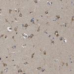 ZDHHC17 Antibody in Immunohistochemistry (Paraffin) (IHC (P))