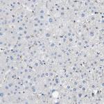ZDHHC17 Antibody in Immunohistochemistry (Paraffin) (IHC (P))