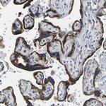 ZDHHC17 Antibody in Immunohistochemistry (Paraffin) (IHC (P))