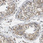 ZDHHC17 Antibody in Immunohistochemistry (Paraffin) (IHC (P))