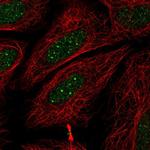 RNF41 Polyclonal Antibody