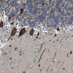 RNF41 Antibody in Immunohistochemistry (Paraffin) (IHC (P))