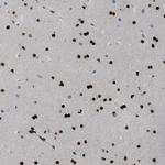 ZBTB20 Antibody in Immunohistochemistry (Paraffin) (IHC (P))