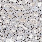 ZBTB20 Antibody in Immunohistochemistry (Paraffin) (IHC (P))