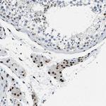 ZBTB20 Antibody in Immunohistochemistry (Paraffin) (IHC (P))