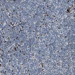 ZBTB20 Antibody in Immunohistochemistry (Paraffin) (IHC (P))