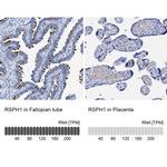 TSGA2 Antibody in Immunohistochemistry (IHC)
