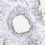 TSGA2 Antibody in Immunohistochemistry (IHC)