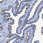 TSGA2 Antibody in Immunohistochemistry (IHC)