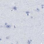 TSGA2 Antibody in Immunohistochemistry (IHC)