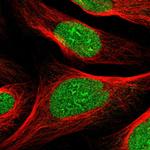 ZNF297B Antibody in Immunocytochemistry (ICC/IF)