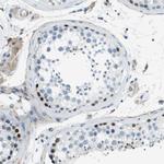 ZNF297B Antibody in Immunohistochemistry (Paraffin) (IHC (P))