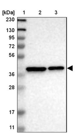 TMEM19 Antibody in Western Blot (WB)