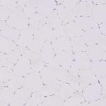 INHBE Antibody in Immunohistochemistry (Paraffin) (IHC (P))