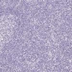 INHBE Antibody in Immunohistochemistry (Paraffin) (IHC (P))