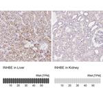 INHBE Antibody in Immunohistochemistry (IHC)