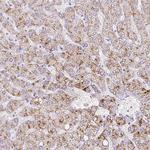 INHBE Antibody in Immunohistochemistry (IHC)