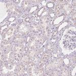 INHBE Antibody in Immunohistochemistry (IHC)