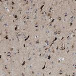 PTDSS1 Antibody in Immunohistochemistry (Paraffin) (IHC (P))