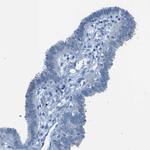 SLC16A10 Antibody in Immunohistochemistry (Paraffin) (IHC (P))
