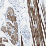 SLC16A10 Antibody in Immunohistochemistry (Paraffin) (IHC (P))