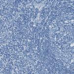 SLC16A10 Antibody in Immunohistochemistry (Paraffin) (IHC (P))