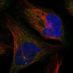 CTIF Polyclonal Antibody