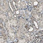 CTIF Antibody in Immunohistochemistry (IHC)