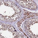 ZBTB39 Antibody in Immunohistochemistry (IHC)