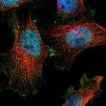 DHRS7B Polyclonal Antibody