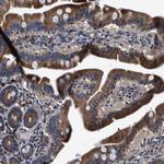 DHRS7B Antibody in Immunohistochemistry (Paraffin) (IHC (P))