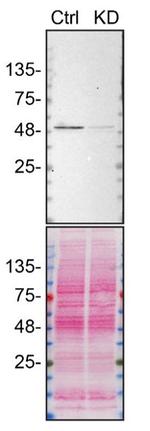 hnRNP H2 Antibody