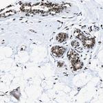 hnRNP H2 Antibody in Immunohistochemistry (IHC)