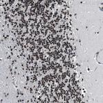 hnRNP H2 Antibody in Immunohistochemistry (IHC)