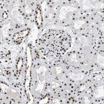 hnRNP H2 Antibody in Immunohistochemistry (IHC)