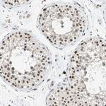 hnRNP H2 Antibody in Immunohistochemistry (IHC)