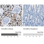 C21orf62 Polyclonal Antibody
