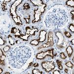 C21orf62 Antibody in Immunohistochemistry (IHC)