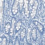 C21orf62 Antibody in Immunohistochemistry (IHC)