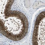 ENPP5 Antibody in Immunohistochemistry (IHC)