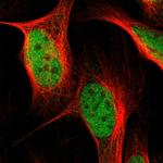 NEK11 Antibody in Immunocytochemistry (ICC/IF)