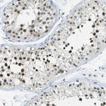 NEK11 Antibody in Immunohistochemistry (Paraffin) (IHC (P))
