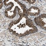 HEBP2 Polyclonal Antibody