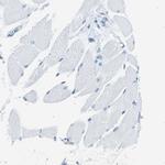 PITHD1 Antibody in Immunohistochemistry (IHC)