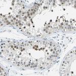 PITHD1 Antibody in Immunohistochemistry (IHC)