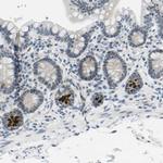 PITHD1 Antibody in Immunohistochemistry (IHC)