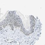 PITHD1 Polyclonal Antibody